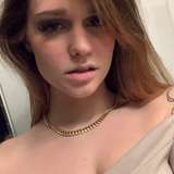 xoxodimerose